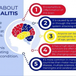 Encephalitis