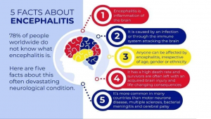 Read more about the article Encephalitis
